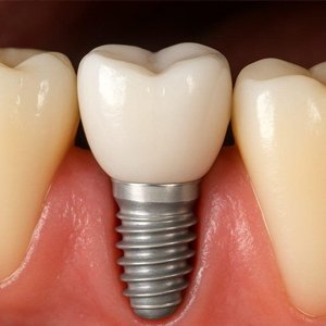 Prosthodontics & Rehabilitation-300x300