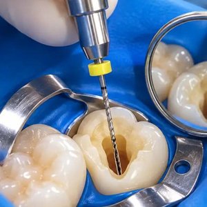 Conservative & Endodontics-300x300
