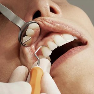 Periodontics-300x300